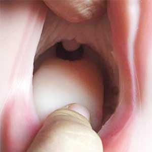 Enhanced Mouth