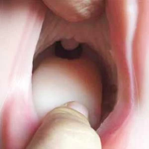 Enhanced Mouth