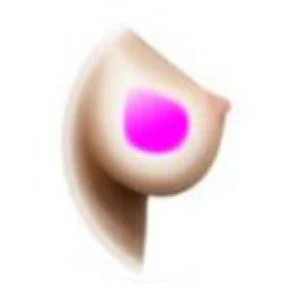 Gel Breasts